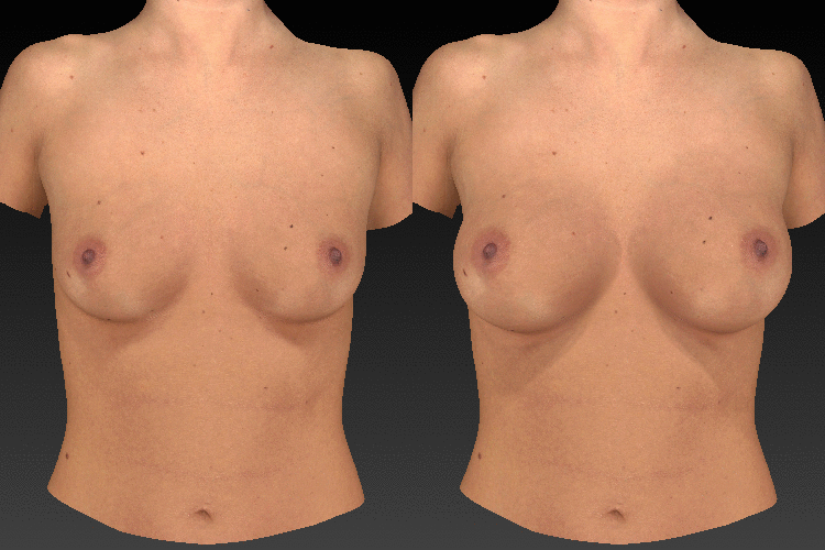 Breast Sculptor Animation