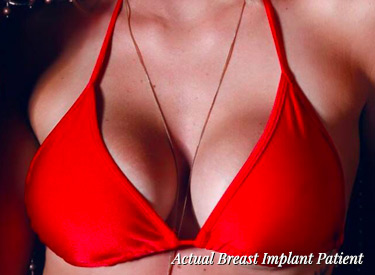 Plastic Surgery Breast Procedures Columbus