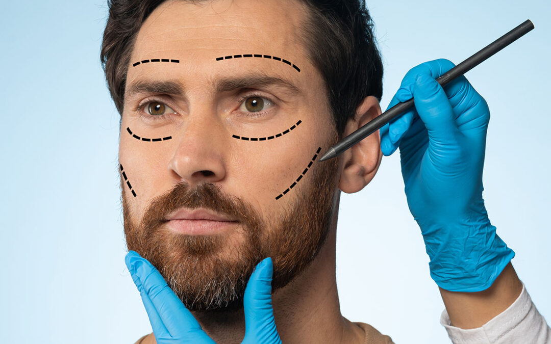Middle aged man getting pencil marks on face skin for cosmetic surgery, ready for operation, blue background