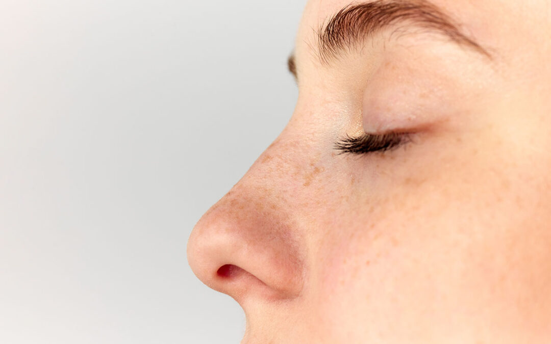 Young woman, girl demonstrating nose after, before surgery